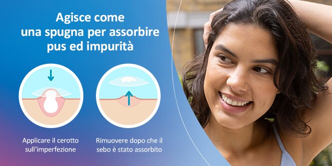 Grafico che illustra come funzionano i cerotti per acne Nexcare™ Acne Patches, assorbendo grasso dai pori ostruiti
