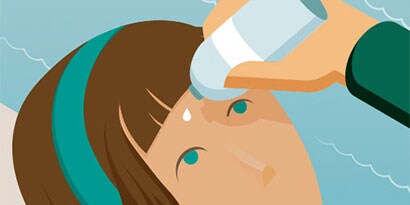 I RIMEDI PER LE IRRITAZIONI DEGLI OCCHI. CONSIGLI PER LE LESIONI OCULARI