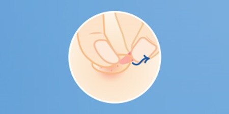 PASSO 3 - Il cerotto diventa in bianco - è il momento di rimuovere il cerotto per brufoli e applicarne uno nuovo

